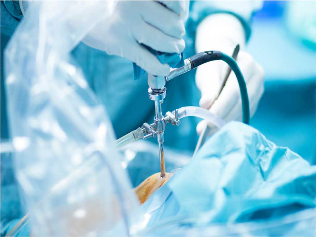 Arthroscopic Surgery in North Hollywood, Los Angeles & Echo Park - Urgent Orthopaedic Care