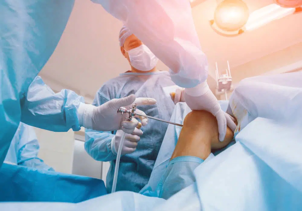 Doctors performing Arthroscopic Surgery in Los Angeles